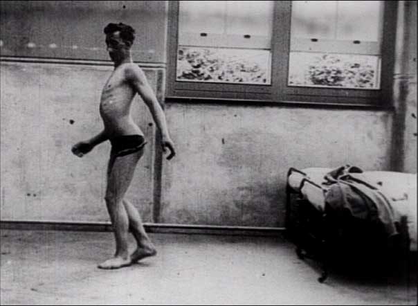 Netley-shell-shock-1917